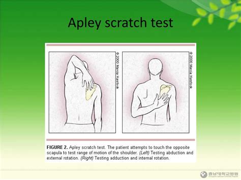 apley scratch test|Iba pa.